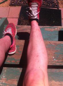 My legs after beetroot